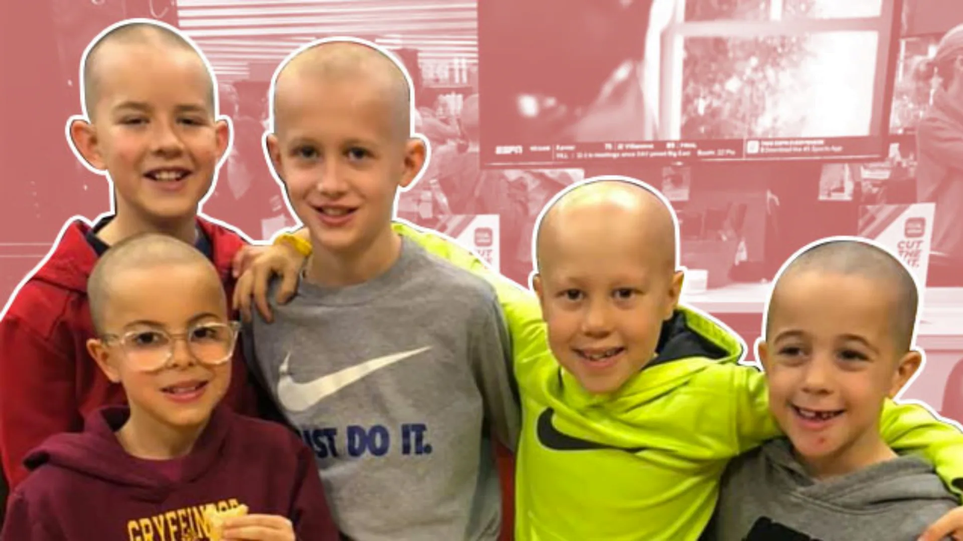 New Hope for Kids With Severe Alopecia (EMA Review)
